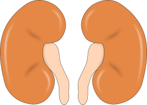 kidney stone size chart